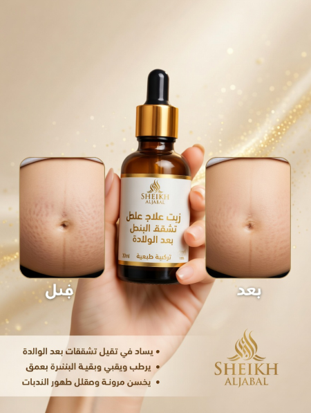 زيت علاج تشققات الحمل \Pregnancy stretch marks treatment oil
