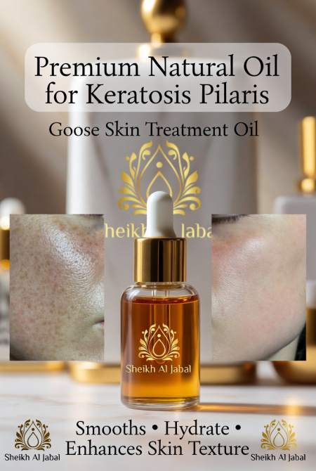 زيت علاج جلد الوزه /الاصلي